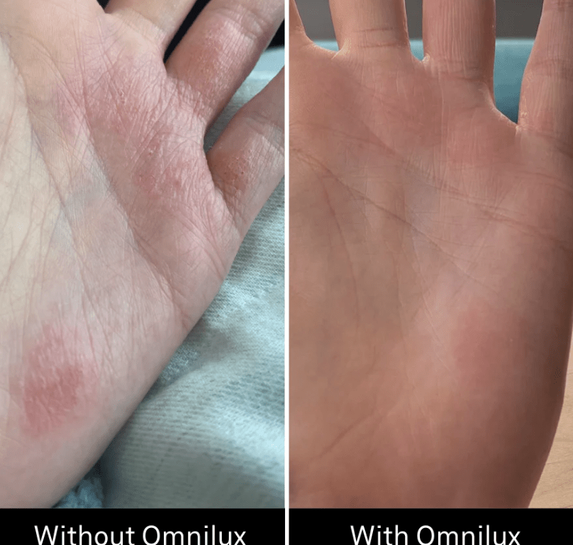 Omnilux Contour Glove