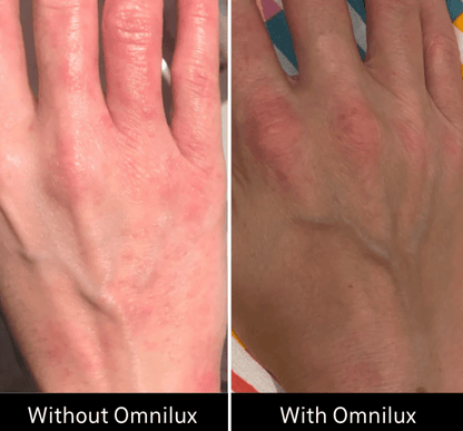 Omnilux Contour Glove