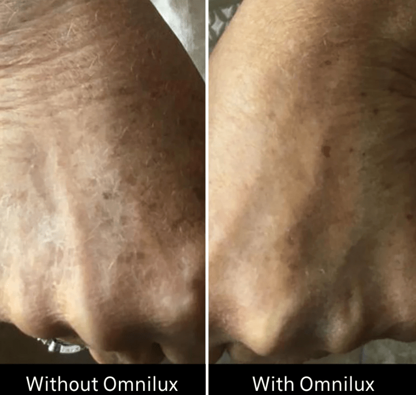 Omnilux Contour Glove