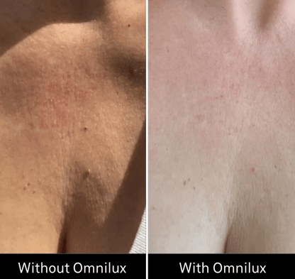 Omnilux Contour Neck & Décolleté