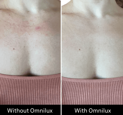 Omnilux Contour Neck & Décolleté