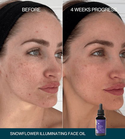 Edible Beauty & Snowflower Illuminating Face Oil 15ml