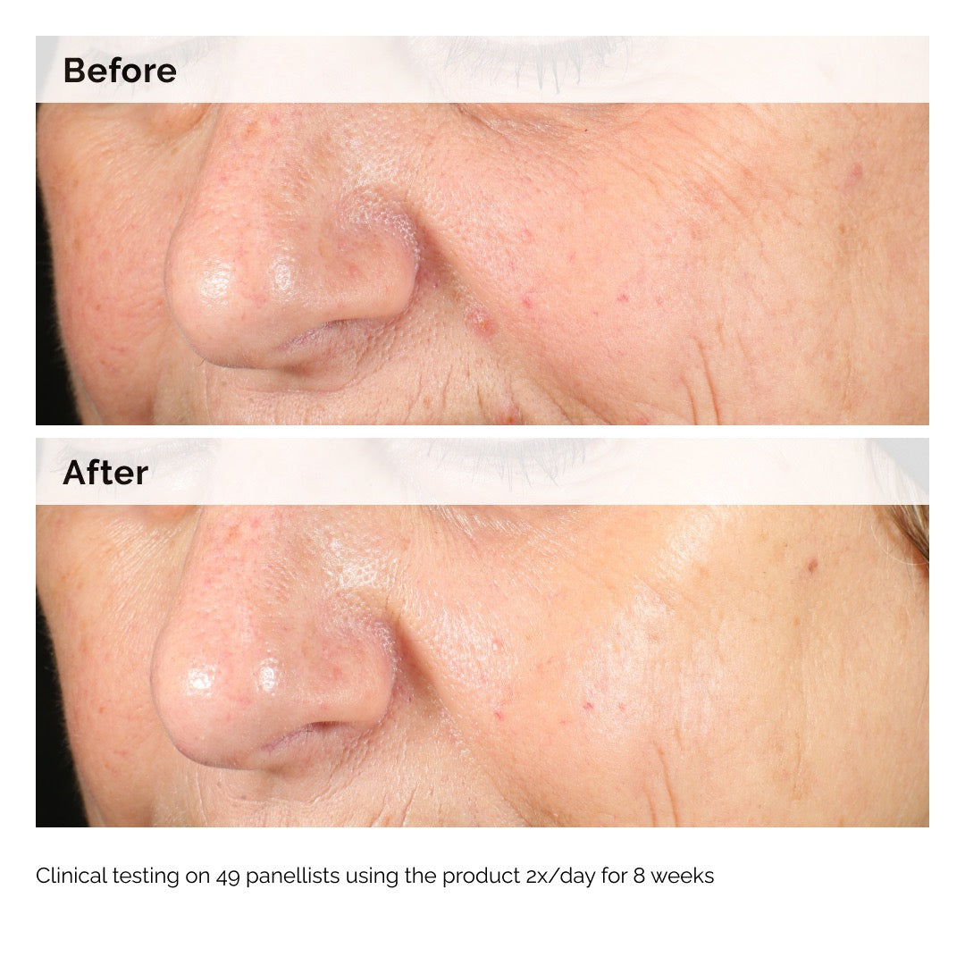 The Ordinary The Ordinary Alpha Arbutin 2% + HA - 30ml Serums & Treatments