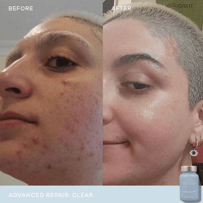 Vida Glow Clear Advanced Repair - 30 capsules 2 Pack