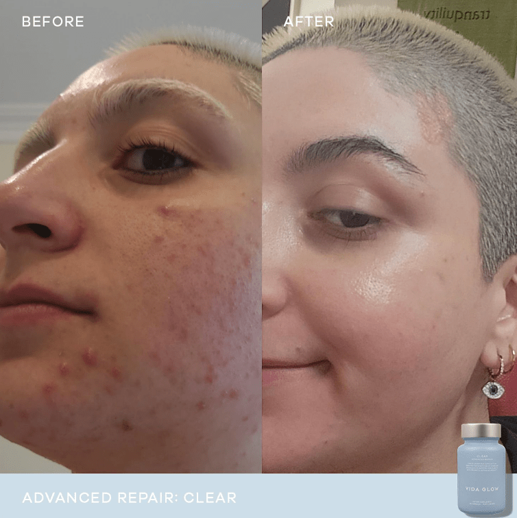 Vida Glow Clear Advanced Repair - 30 capsules 3 Pack