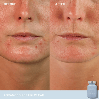 Vida Glow Clear Advanced Repair - 30 capsules 2 Pack