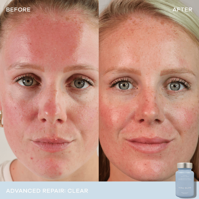 Vida Glow Clear Advanced Repair - 30 capsules 2 Pack