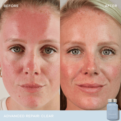 Vida Glow Clear Advanced Repair - 30 capsules 3 Pack