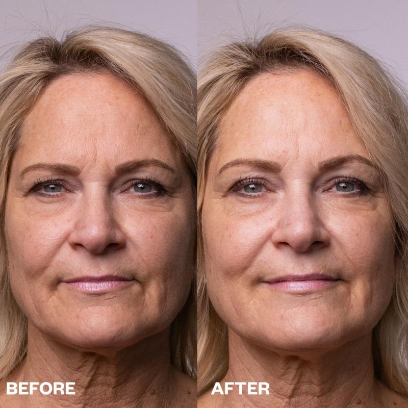 Wrinkles Schminkles Face Polishing Peel Pads - 5 pack