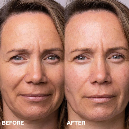 Wrinkles Schminkles Face Polishing Peel Pads - 5 pack