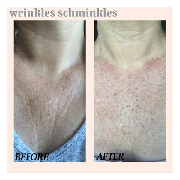 Wrinkles Schminkles Chest Wrinkle Patch