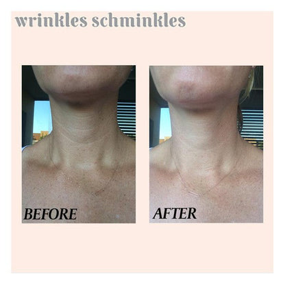 Wrinkles Schminkles Neck Smoothing Patch